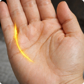 손바닥 형태 예시